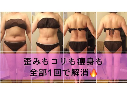 レヴィ(Revie)の写真