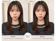 サロン ド ルリエ(Salon De Reliel)/立体小顔造形コルギ