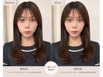 サロン ド ルリエ(Salon De Reliel)/立体小顔造形コルギ