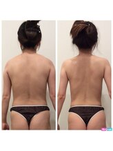 ミエル(Miel)/Before After