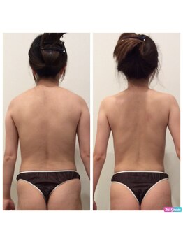ミエル(Miel)/Before After
