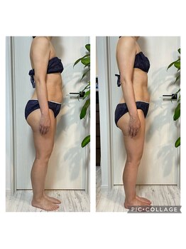 フェザー(Feather)/アーユルヴェーダ１回施術