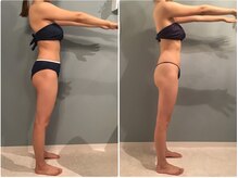 ボディエステティック アクアオーラ 高岡店/