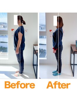 整体院ひなた 都城院/当院大人気産後骨盤矯正!!