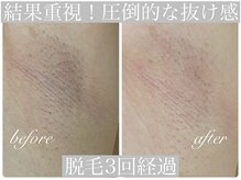 アリスビューティー(AliceBeauty)/圧倒的抜け感！満足度◎