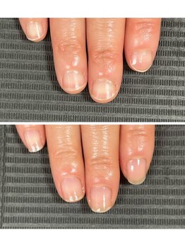 ルカロンネイル(Rukaron Nail)/貝爪