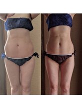 サロンドルポゼ(Salon de reposer)/