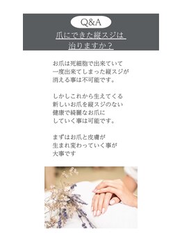 ビエル(BIeL)/京都自爪育成 フィルイン