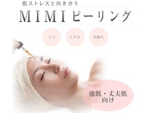 ヴィオール 名古屋栄店(VIOR)/美白・強め酸性ピーリング☆