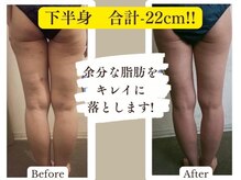 ヨサパーク ハニー 大岡山(YOSA PARK Honey)