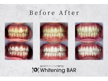 ホワイトニングバー 町田店