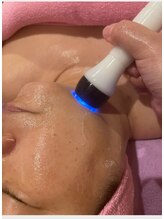 カスミソウ/むくみ取って小顔に