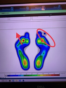メディカルジャパン 吉祥寺/歩行分析