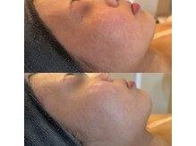 ラドンナ(LA DONNA)/敏感肌