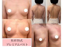 ラヴィス(ravis)の雰囲気（豊胸なしで叶う2カップ以上up！姿勢も整う新技術！）