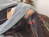 【不眠　眠りにくい】睡眠にお困りの方に　頭皮の緊張緩和の鍼灸