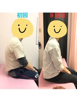 健スマ整骨院 大津院/ビフォーアフター