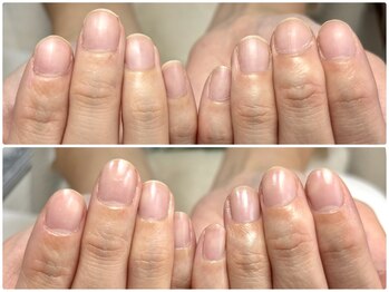 ケア育成で美爪育成も◎ケア