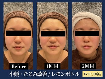 エヴァーグレース 川崎店/Z世代に人気韓国美容ができる店!