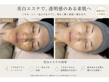 マハナ(mahana)の写真/解剖学に基づくエステで美白と毛穴ケアを両立。たるみに寄り添う至福の時間を◎
