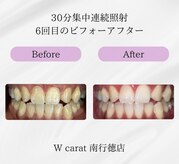 ダブルカラット 南行徳店(W carat)