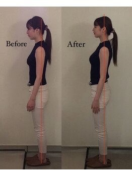 コルミチョン サロン(骨美整 salon)/姿勢　Before・After 