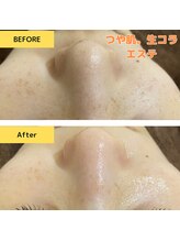 サバス(Sabbath)/人気のつや肌。美肌エステ