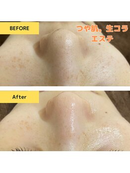 サバス(Sabbath)/人気のつや肌。美肌エステ