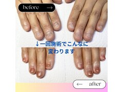 深爪矯正・自爪育成サロン　BLOOMブルーム（旧：nail&beautysalon  BLOOM）