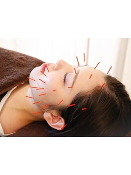 鍼灸施術を受けたい