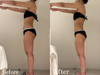 カレンジェビューティー(CarengeBeauty)/四日市痩身/スリムカッター