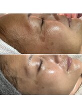 エステティックサロン S/ビフォーアフター