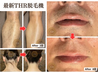 サロンゼロ 池上店(Salon ZERO)の写真