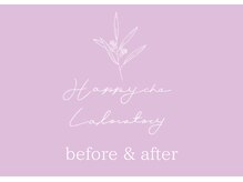 しあわせ腸研究所/腸もみbefore & after