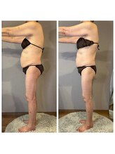 エネイブル(ENable)/