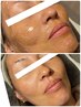 先着25名！初回限定！フェイスワックス＋HYDROJELLYMASKのセット ¥6,600