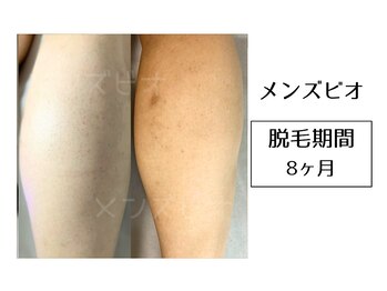 メンズビオ 神戸三宮店/