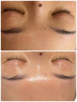 コア(Coeur)/befor→after