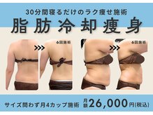 イエス マイサロン(yes My Salon)の雰囲気（【脂肪冷却で徹底ケア！】脂肪細胞ごと減少させる最先端技術）