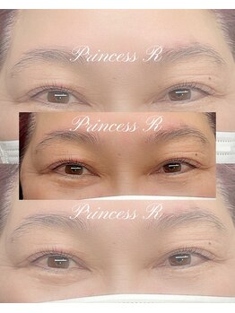 プリンセスアール(Princess R)/トリートメントまつげカール