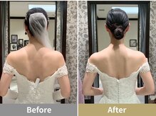 せなかのはね 井尻店/20代肩甲骨が出ない　ブライダル