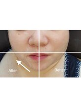 アリュール(Allure)/引き上がり実感！！