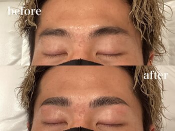 モテテ(motete)/お客様施術例☆栄本店