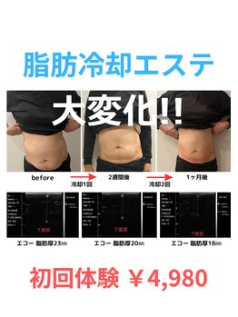 心斎橋長堀フェムテック整骨院/脂肪冷却 整体 心斎橋 大阪