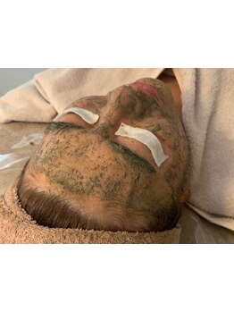 お肌をきれいにしたい