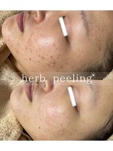 スリリアン 銀座/★お客さまビフォーアフター★