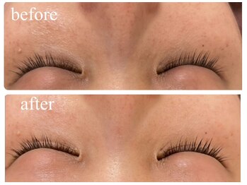 チェリーブロッサム 立川店(CHERRY BLOSSOM)/眼精疲労&クマケア