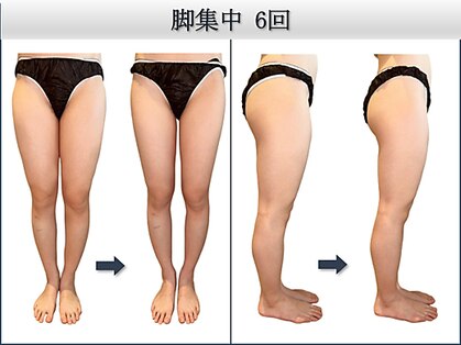 椿(TSUBAKI)の写真