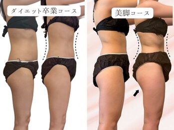 ヨサパーク フェリシア 西荻窪(YOSA PARK Felicia)/短期期間で集中ダイエット!