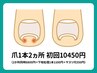 【専門技術】食い込み・違和感ケア「巻き爪改善コース爪1本2ヵ所」